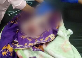 Polres Simalungun Selidiki Kasus Bayi Yang Ditemukan Terlantar di Kebun Teh Sidamanik.